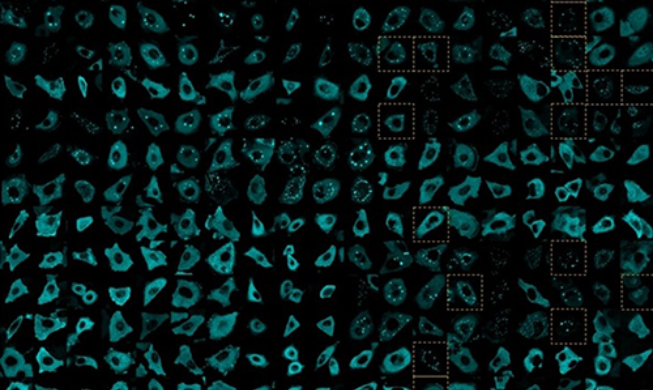 韩美研究团队破解癌症转移的“细胞迁移之谜”